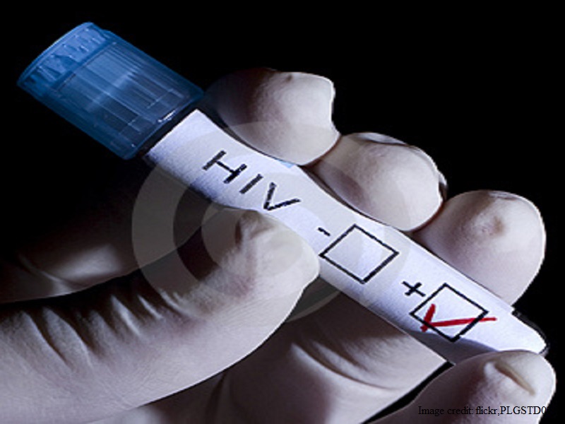 35 a lot more HIV patients covering in Larkana