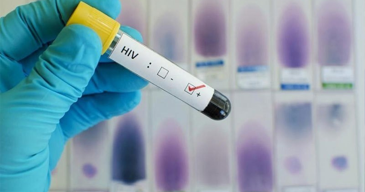دنیا کی پہلی خاتون ایچ آئی وی سے صحت یاب ہو گئی￼