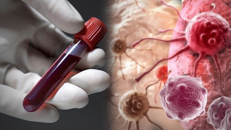نیا خون کا ٹیسٹ جو علامات سے پہلے کینسر کی پہچان کر سکتا ہے