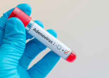 کراچی میں ایڈینو وائرس پھیلنے کا خدشہ محکمہ صحت کے حکام الرٹ