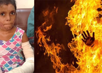 کراچی میں آٹھ سالہ بچی کو سوتیلے باپ نے آگ لگا دی، افسوسناک واقعہ