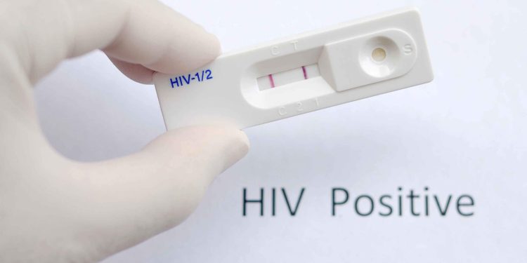 سوات: بدین میں ایڈز کے 126 کیسز پازیٹو آ گئے