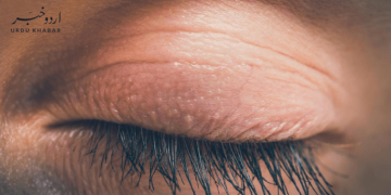 ہم پلکیں کیوں جھپکتے ہیں؟