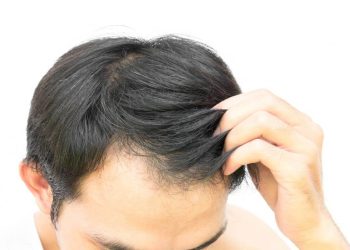 کیا شیمپو لگانے سے گنجا پن جلدی آتا ہے؟