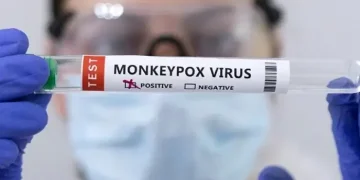 افریقہ میں پھیلنے والا منکی پوکس وائرس کا پاکستان میں پہلا کیس رجسٹرڈ