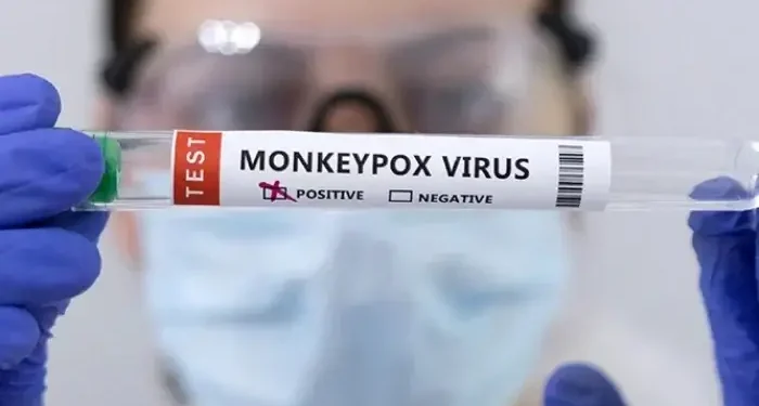 افریقہ میں پھیلنے والا منکی پوکس وائرس کا پاکستان میں پہلا کیس رجسٹرڈ