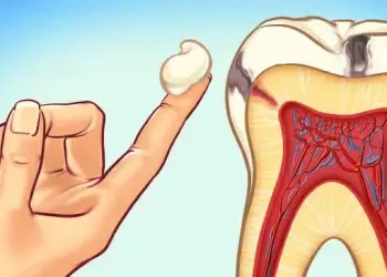 داڑھ میں درد کا علاج جانئے 5 طریقے