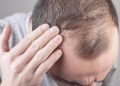 دس غذائیں جو سر کے بالوں کو گرنے سے بچا سکتی ہیں