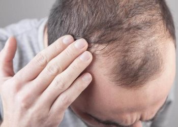 دس غذائیں جو سر کے بالوں کو گرنے سے بچا سکتی ہیں