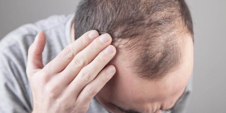 دس غذائیں جو سر کے بالوں کو گرنے سے بچا سکتی ہیں