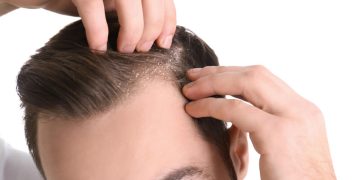 سر کے بالوں کی خشکی ختم کرنے کے دیسی ٹوٹکے