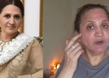 اداکارہ اسماء عباس کو جلد کے علاج کے بعد شدید الرجی