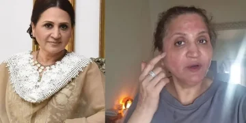 اداکارہ اسماء عباس کو جلد کے علاج کے بعد شدید الرجی